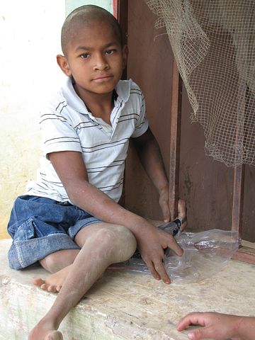 child with disability